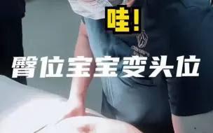 一名产科女医生晒出绝技: 10秒钟！ 徒手帮一位臀位宝宝掉转胎头，助力宝妈平安顺产。
