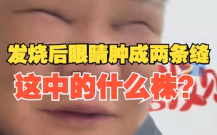 男子发烧后眼睛肿成两条缝，灵魂发问：这中的什么株？