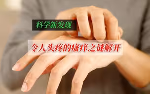 令人头疼的瘙痒之谜解开