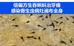 信偏方生吞蝌蚪治牙痛，感染寄生虫病灶遍布全身