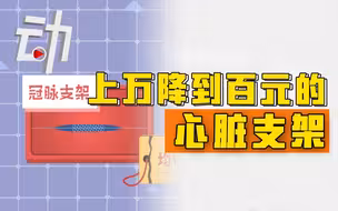 从上万降到百元：心脏支架的“水分”为啥这么多？