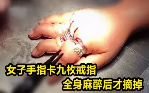 女子手指卡九枚戒指全身麻醉后才摘掉