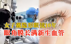 女子戴隐形10年角膜长满新生血管：患有高度近视，每天戴近10小时