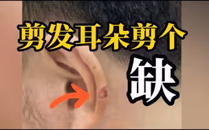 北京男子理发时耳朵被剪掉一块肉，店家态度蛮横，报警后也拒不配合
