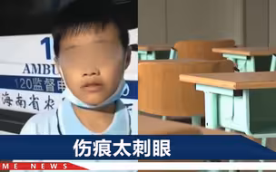三亚一小学生称被老师打了40多下，屁股发紫肿胀，区教育局回应