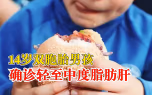14岁双胞胎作息不健康同患脂肪肝：饮食口味重，作业多没时间运动