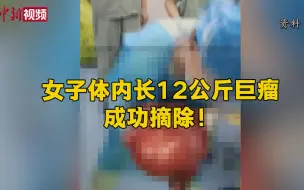 女子体内长12公斤巨瘤 大小如足球