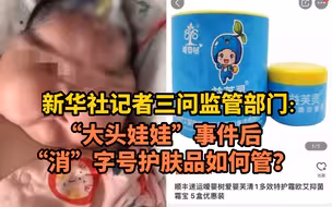 新华社记者三问监管部门：“大头娃娃”时间后“消”字号护肤品如何管？