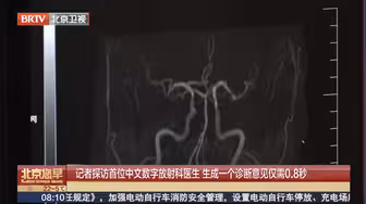 生成一个病例诊断意见仅需0.8秒！首位中文数字放射科医生诞生