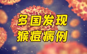 欧美多地发现猴痘病例 专家呼吁民众保持镇静
