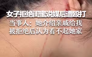 女子拒绝闺蜜说媒后遭殴打 当事人：她介绍亲戚给我 被拒绝后认为看不起她家