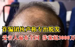 专治脱发诈骗团伙被抓涉案3000万：冒充专业医师，受害者遍布全国