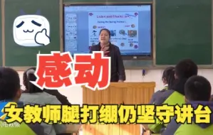 感动！聊城一女教师腿打绷带仍坚守讲台 她说“耽误学生上课于心不忍”