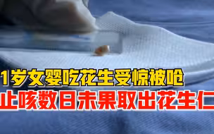 幼童止咳数日未果气管取出花生仁，母亲：被呛时就吐了，以为没事