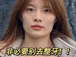 去整牙的 先进来冷静一下！！
