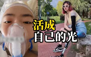 车祸失去手和腿，男友劈腿，她挺过来了，活成自己的一道光！