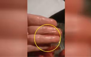 澳大利亚发生多起草莓被人恶意藏针事件