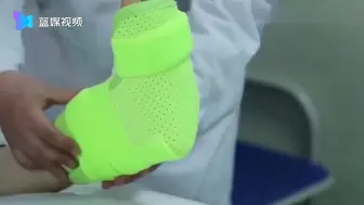 可代替传统石膏 清华科学家研发出液态金属外骨骼