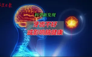 牙齿不好或影响脑健康