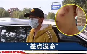 浙江一男子深夜开车出门，被陌生人咬了十几口：至今没收到道歉