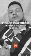 巴西28岁歌手被蜘蛛咬脸 身体感到疲劳淤伤变黑 仅6天后去世