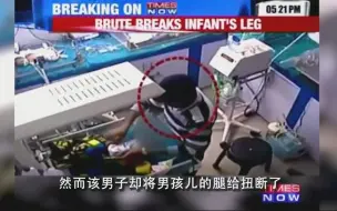 印度一医院工作人员因男童哭泣 恼怒之下扭断其腿