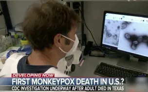 美国出现首例与猴痘有关的死亡病例