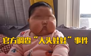 “大头娃娃”事件追踪：涉事产品召回检测！