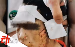 黑龙江被虐女童仍昏迷，生父继母被批捕，生母请求救助
