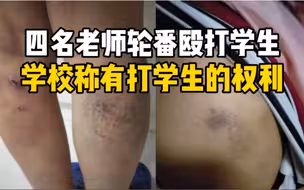 四名老师轮番殴打学生，学校称有打学生的权利