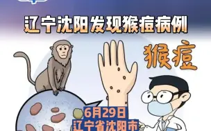 辽宁沈阳发现一例猴痘病例
