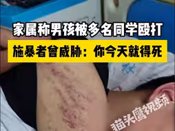 家属称男孩被多名同学殴打，施暴者曾威胁：你今天就得死