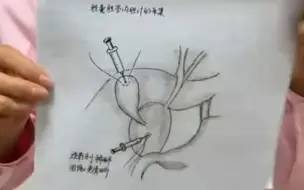 西安儿童医院护士手绘100幅儿童手术图，手绘形式记录手术过程