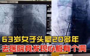 63岁女子头晕20年发现心脏有个洞，医生：先心病，卵圆孔未闭
