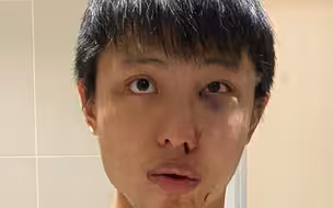“别把新冠病毒带进来！”新加坡留学生在伦敦街头被暴打