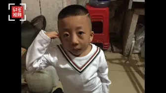 8岁“折叠人”的困境：身高仅90cm 手术前因肺炎住进ICU