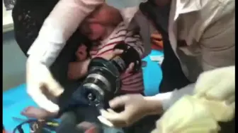惊险！瑞安2岁男童手卡绞肉机！消防指战员10分钟成功解困