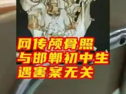 网传颅骨照与邯郸初中生遇害案无关