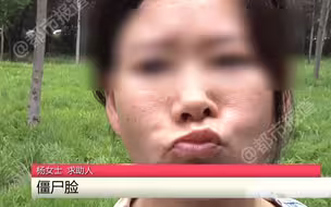 都市报道【做大拉皮能年轻10岁？女子家庭支离破碎：面部神经损伤，僵硬像僵尸！】