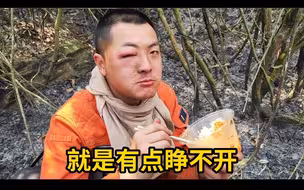 大火烧毁蜂窝，受惊野蜂蛰伤消防战士眼睛