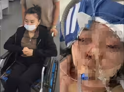 女子新婚两月遭丈夫家暴双目失明：只因没给他游戏充钱