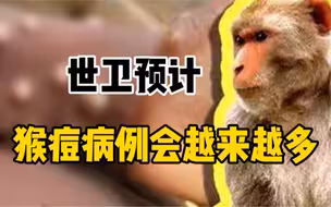瑞士、以色列出现首例猴痘确诊病例，世卫预计全球将出现更多病例