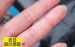 女子扫共享单车，被坐垫上的针划破手