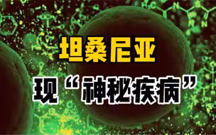 发烧流鼻血！坦桑尼亚3人因“神秘疾病”死亡，已累计确诊13例
