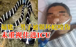 男子被银环蛇咬伤未重视住进ICU：起初伤口不痛，不久后呼吸困难