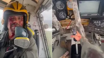 巨鸟撞碎玻璃冲入厄瓜多尔一飞机舱内 飞行员满脸血迹仍淡定驾驶