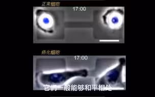 暴脾气的癌细胞！