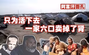 这里的人被夺走了微笑 一家6口卖肾维生 | 走近阿富汗贫民窟