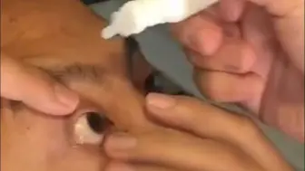 男子长期用激素类眼药水，发展成青光眼晚期 视力跌至0.1，医生提醒：眼药水出现这3个字要警惕