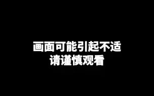 美媒：美国一地惊现狗叼人类断臂，警方在附近发现无头男尸